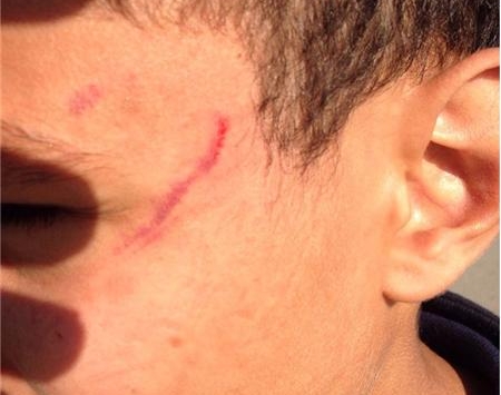 معلمة تضرب تلميذا ضربا مبرحا بمدرسة باباعلي في المدية