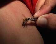 Les piqûres d'abeille pour soulager les maux