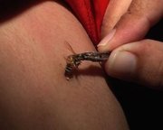 Les piqûres d'abeille pour soulager les maux