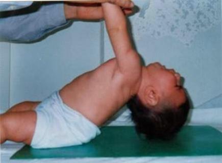 100 طفل بعين تموشنت يعانون من الاعتلال العضلي