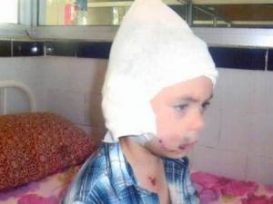 Les pit-bulls sèment la terreur à Souk Ahras : Un enfant de 4 ans sauvagement attaqué