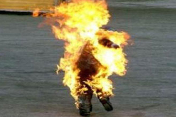 مختل عقليا يحرق نفسه بالشلف