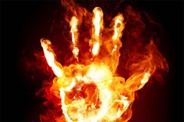 جامعي‮ ‬ينتحر حرقا بمستغانم بسبب عملية جراحية فاشلة‮!‬