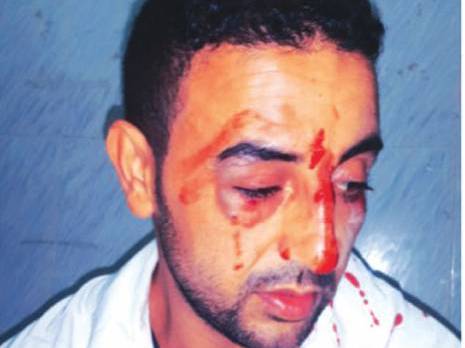 Un agent tabasse un médecin de garde