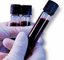 في ظل ندرة الأدوية وارتفاع عدد الوفيات              إحصاء أزيد من 500 إصابة جديدة بسرطان الدم