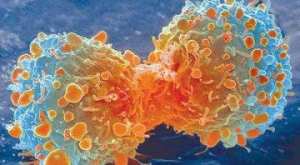 السرطان يهدد 3 آلاف شخص من روّاد مركز تكوين الجلفة