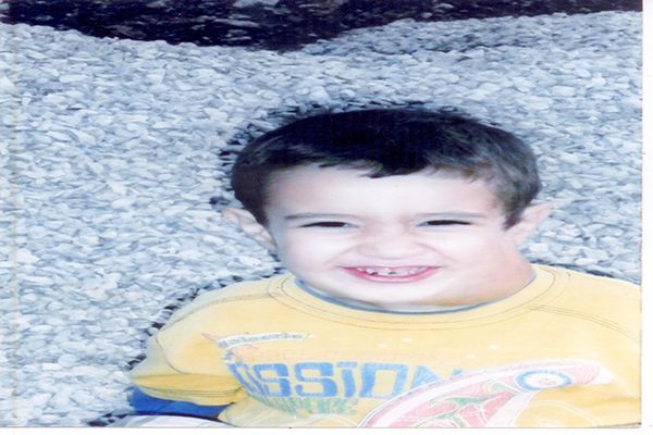 ورم يلتهم رقبة طفل بتيزي وزو والأطباء عاجزون عن علاجه