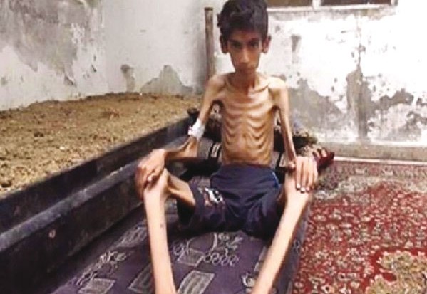 Plus de 60 000 personnes menacées de famine