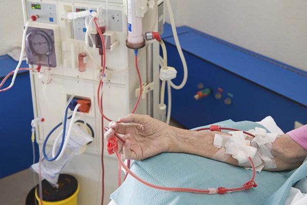 ارتفاع في عدد حالات العجز الكلوي بمدينة إيليزي