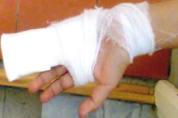 معلمة تكسر أصابع تلميذة بابتدائية في سطيف