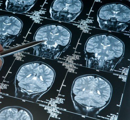 Les risques sur la santé liés à l'utilisation du téléphone cellulaire