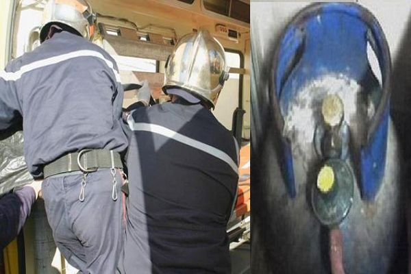 إصابة سيدة وولدها في انفجار قارورة غاز داخل مسكنهما في معسكر