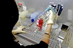 فيما تستقبل مصلحة الأمراض الجلدية بوهران 30 مريضا يوميا              دعوة إلى فتح مخابر للتشخيص المبكر للأمراض الفطرية