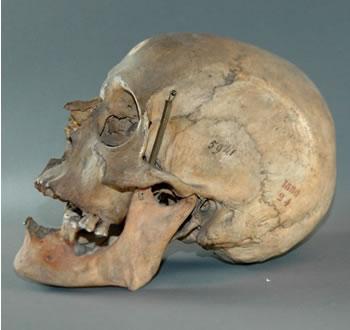 Des cadavres dans le placard