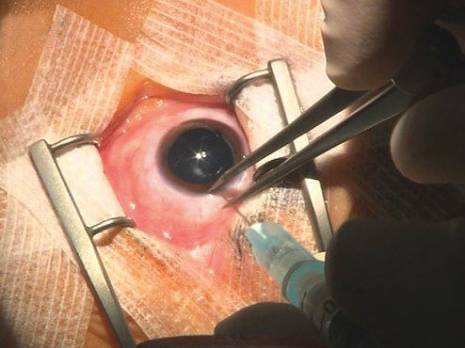 Cinq enfants ont bénéficié hier du traitement conservateur