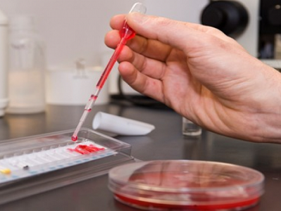 9 حالات للحمى المالطية بعين الزاوية قي تيزي وزو