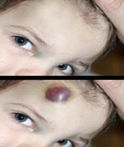 200 أخصائي في مؤتمر متوسطي للجراحة المرممة بوهران               المختصون يؤكدون على ضرورة تعميم الجراحة الترميمية في الجزائر