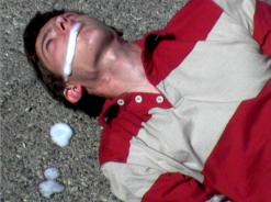 اليوم الطبي الجراحي الأول بالبليدة تسجيل 20 ألف حالة صرع جديدة سنويا