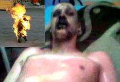 بعد تبسة، جيجل وبرج منايل “الموضة البوعزيزية” تصل إلى مستغانم              يا نار كوني بردا وسلاما على المحتجين