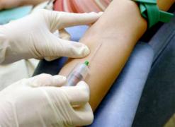 فتح مركز للكشف عن المرض قريبا بالولاية               اكتشاف 75 حالة جديدة لداء السيدا وإحصاء 12 وفاة بسيدي بلعباس