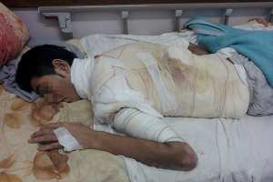 ارتفاع حالات الوفاة صعقا بالكهرباء في الوادي