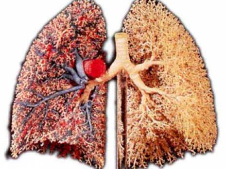 Le manque de chirurgiens accentue la mortalité