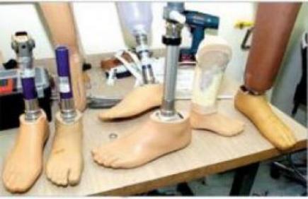 4 ملايين دج لتزويد معاقي تيزي وزو بالأعضاء الاصطناعية