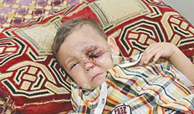 Une mère racle l il de son enfant âgé de 2 ans