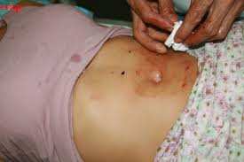 ممرض بعين فراح