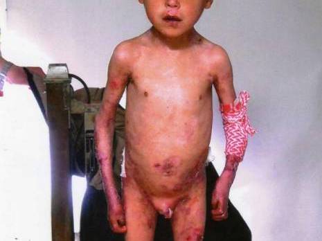 Mascara - Le cri d'alarme de l'enfant Abdallah Moumeni