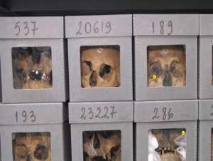 بالصورة: جماجم الجزائريين في المتحف الفرنسي