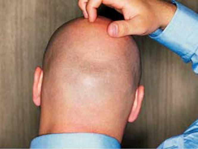 مفاجأة للرجال: لطالما أغرى الصلع الحسناوات.