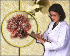 سرطان عنق الرحم يقتل أربع نساء يوميا