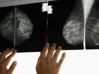 Plus de 3.000 cas de cancer recensés en 2016