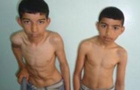 الأخوان صالح ووسام مهددان بالإعاقة