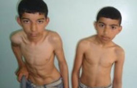 الأخوان صالح ووسام مهددان بالإعاقة