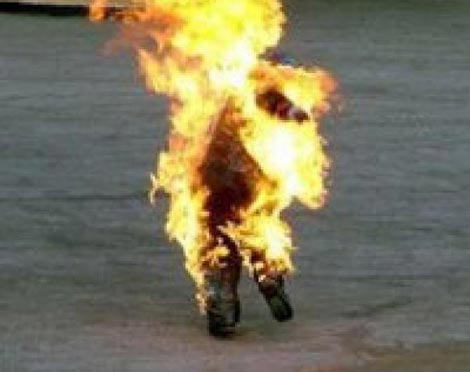 شاب يحاول الانتحار حرقا بمحاذاة الإذاعة بالعاصمة