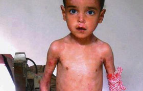 الطفل عبد الله مومني من معسكر يحتاج مساعدة عاجلة من ذوي القلوب الرحيمة