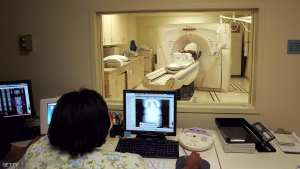 خبر سار عن  سرطان الثدي