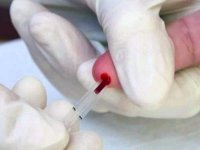 Les patients atteints du VIH-sida ne reviennent plus après le diagnostic