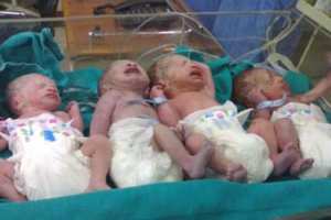 سيدة تضع 4 توائم بسكيكدة