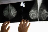 Plus de 1.200 femmes de régions enclavées bénéficient d'un examen