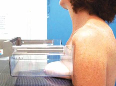 Le dépistage de masse s'impose