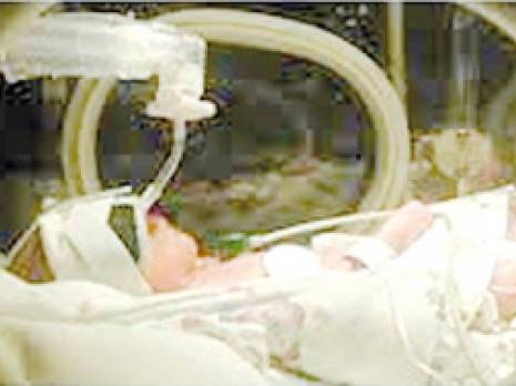 Naissances prématurées : 7,4 pour 100 naissances en Algérie