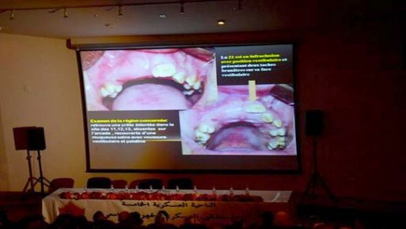 طب الأسنان لدى الأطفال موضوع نقاش بقسنطينة