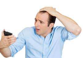 3 أسباب  نفسية  وراء تساقط الشعر