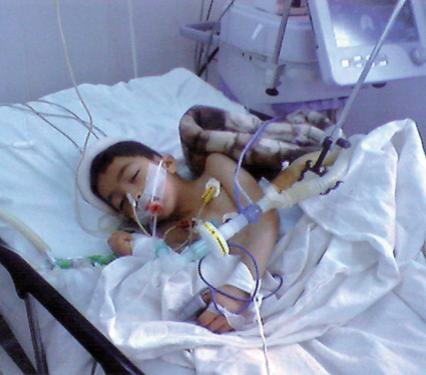 طفل يتوفى بسبب استئصال اللوزتين بتبسة