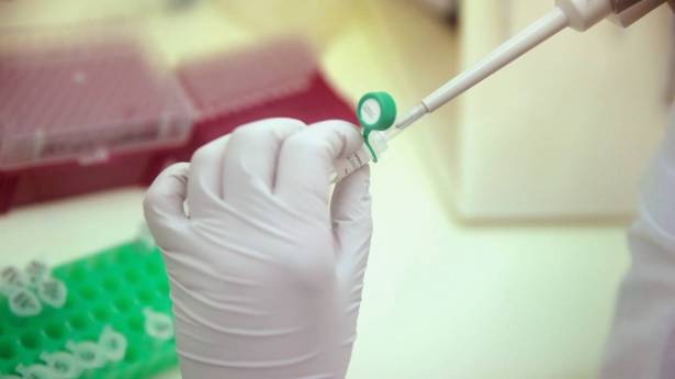 الرجال أم النساء أكثر عرضة للإصابة بالفيروسات؟