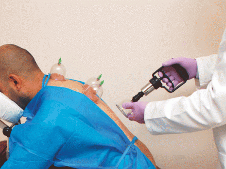 Hijama, roqia, rituels... démêler le vrai du faux