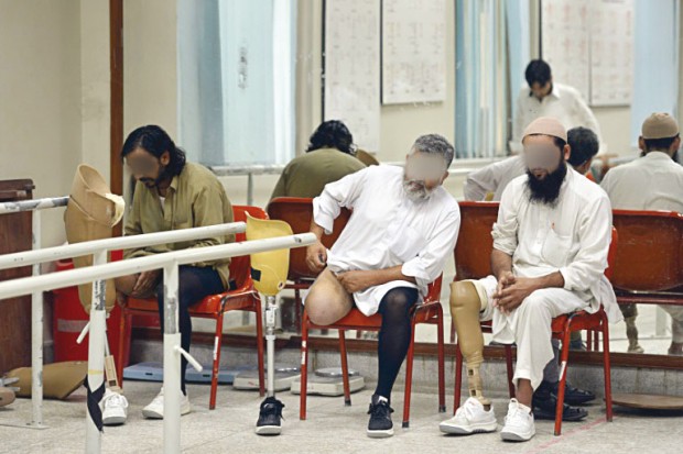 Pose de prothèses orthopédiques